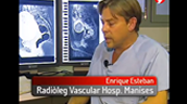 Hospital de Manises - Tratamiento de Mioma