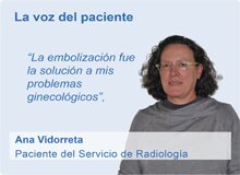 La embolización fue la solución a mis problemas ginecológicos